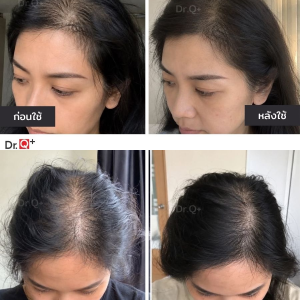 Dr.Q Advanced Hair Serum